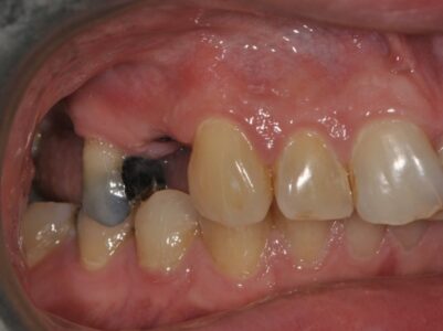 Before - Brunswick Dental Practice