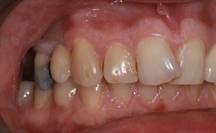 After - Brunswick Dental Practice