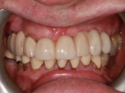 After - Brunswick Dental Practice