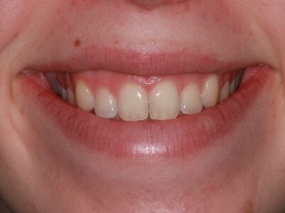 Before - Brunswick Dental Practice