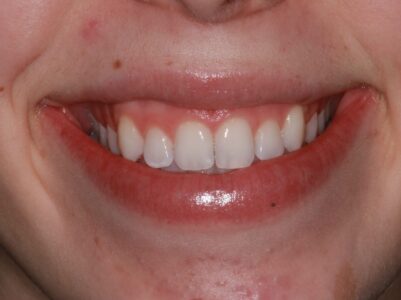 After - Brunswick Dental Practice