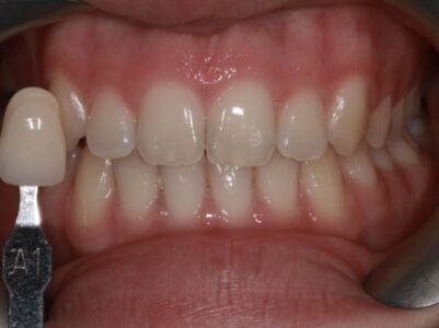 Before Face - Brunswick Dental Practice