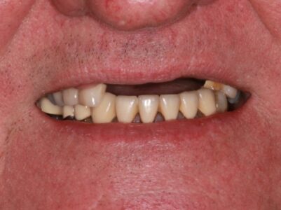 Before - Brunswick Dental Practice