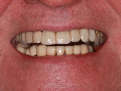 After - Brunswick Dental Practice