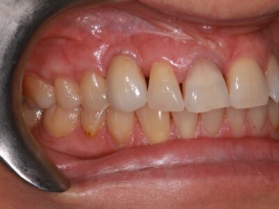 After - Brunswick Dental Practice