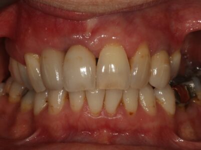 After - Brunswick Dental Practice