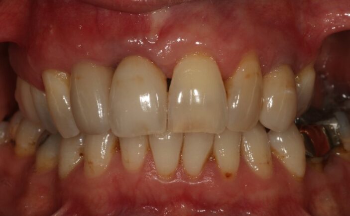 After - Brunswick Dental Practice