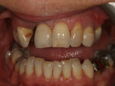 Before - Brunswick Dental Practice