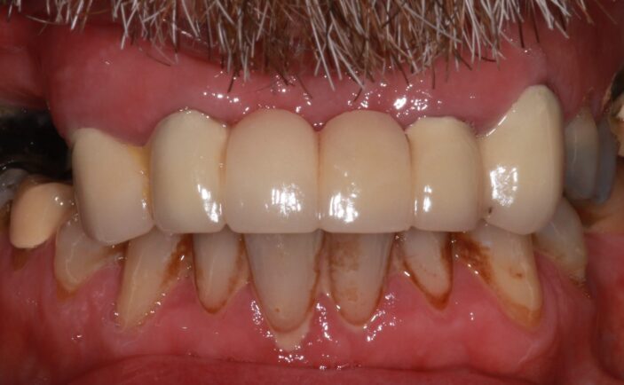 Before - Brunswick Dental Practice