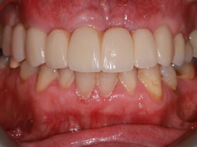 After - Brunswick Dental Practice