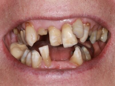 Before - Brunswick Dental Practice