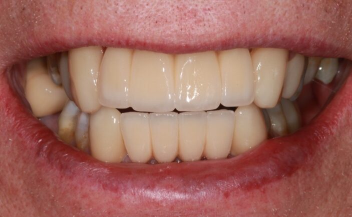 After - Brunswick Dental Practice