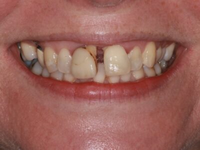 Before - Brunswick Dental Practice