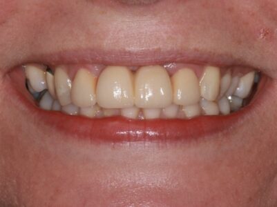 After - Brunswick Dental Practice