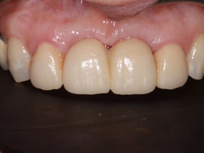 After - Brunswick Dental Practice