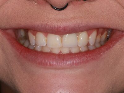 After - Brunswick Dental Practice