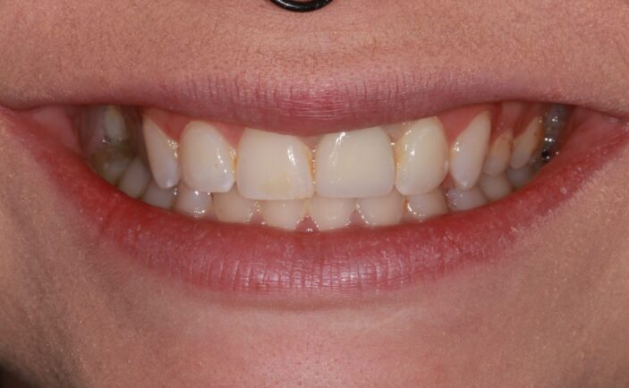 After - Brunswick Dental Practice