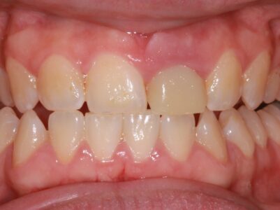 Before Face - Brunswick Dental Practice