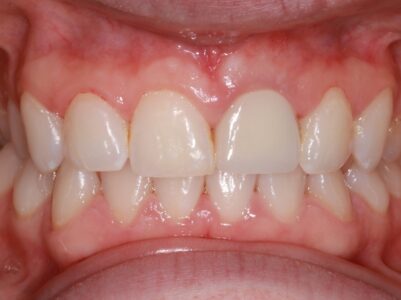 After - Brunswick Dental Practice