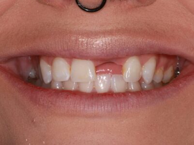 Before - Brunswick Dental Practice