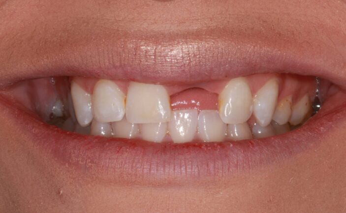 Before - Brunswick Dental Practice