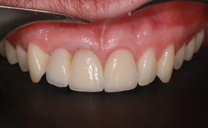 After - Brunswick Dental Practice