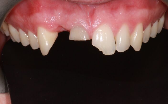 Before - Brunswick Dental Practice