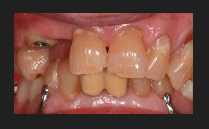 Before - Brunswick Dental Practice