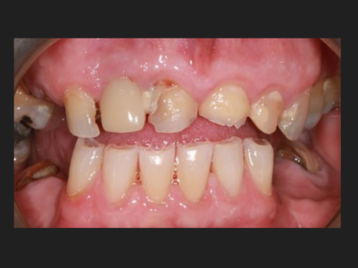 Before - Brunswick Dental Practice