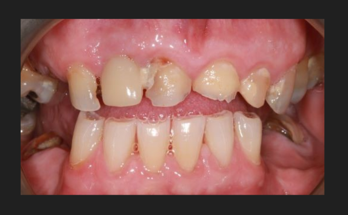 Before - Brunswick Dental Practice