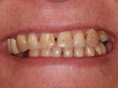 Before Face - Brunswick Dental Practice