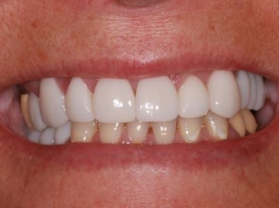 After - Brunswick Dental Practice