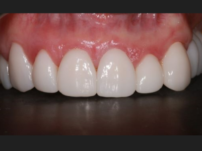 After - Brunswick Dental Practice