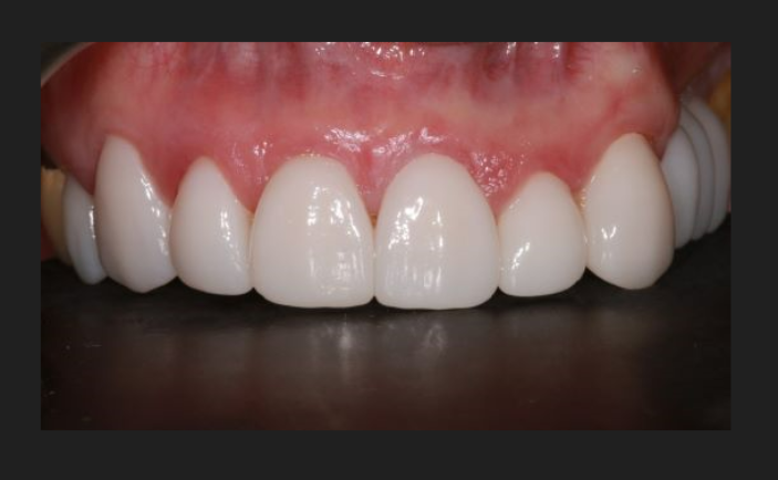 After - Brunswick Dental Practice