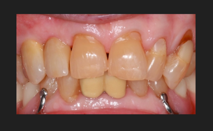 After - Brunswick Dental Practice