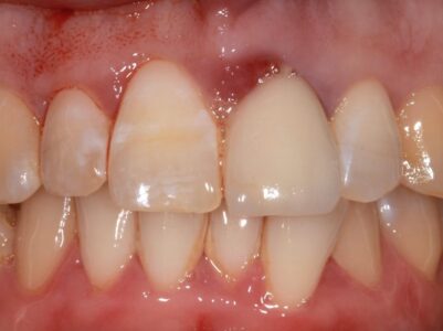 Before - Brunswick Dental Practice