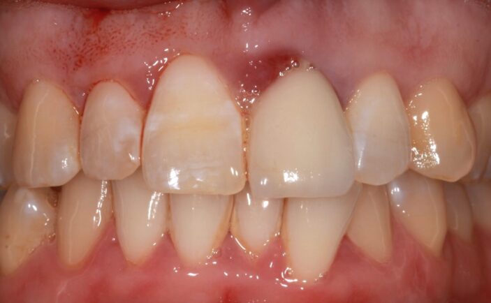 Before - Brunswick Dental Practice