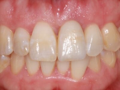 After - Brunswick Dental Practice