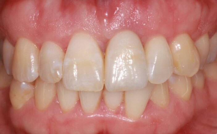 After - Brunswick Dental Practice