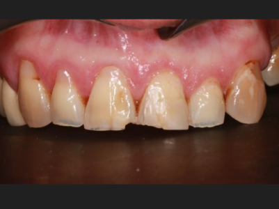 Before - Brunswick Dental Practice