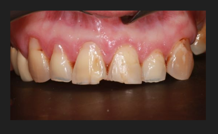 Before - Brunswick Dental Practice