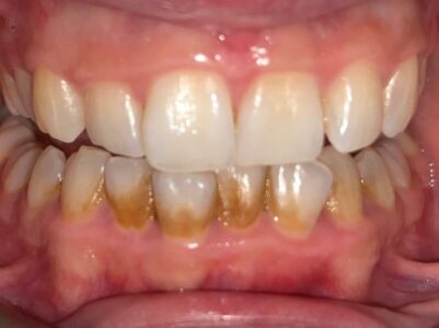 Before - Brunswick Dental Practice