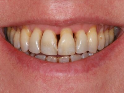 Before - Brunswick Dental Practice