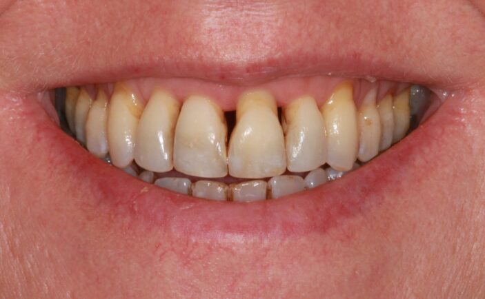 Before - Brunswick Dental Practice