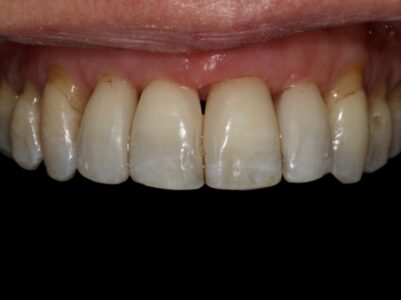 After - Brunswick Dental Practice