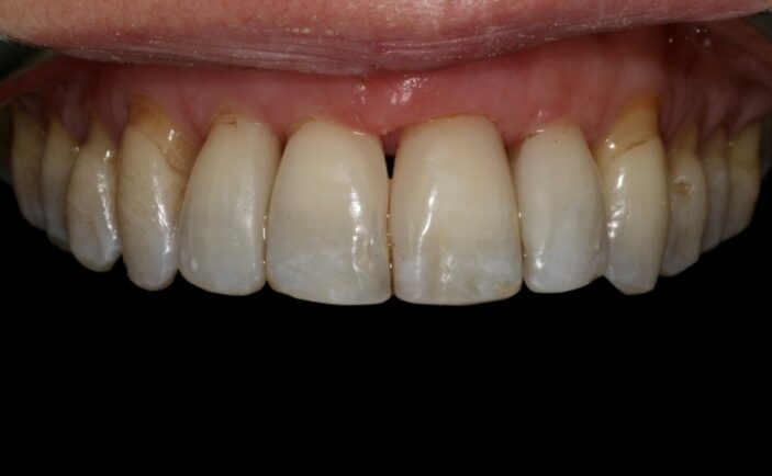 After - Brunswick Dental Practice