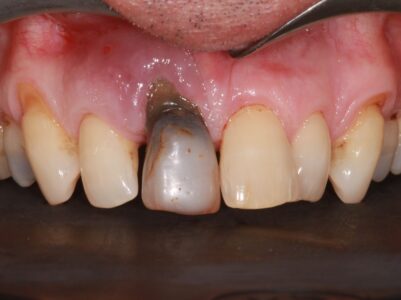 Before - Brunswick Dental Practice