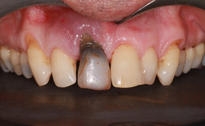 Before - Brunswick Dental Practice