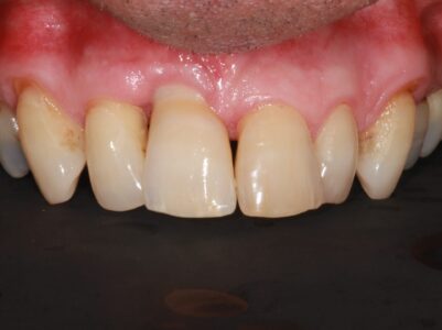 After - Brunswick Dental Practice