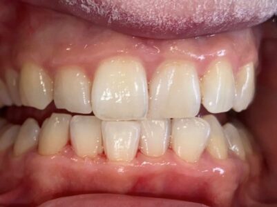 After - Brunswick Dental Practice